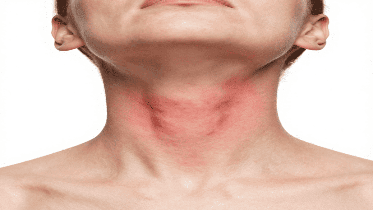 severe itchy rash on neck emergency signs