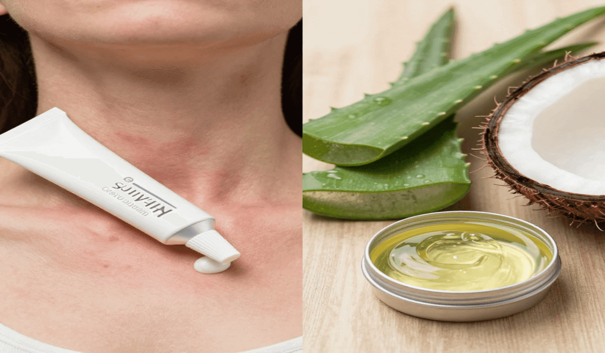 treatment options for itchy rash on neck