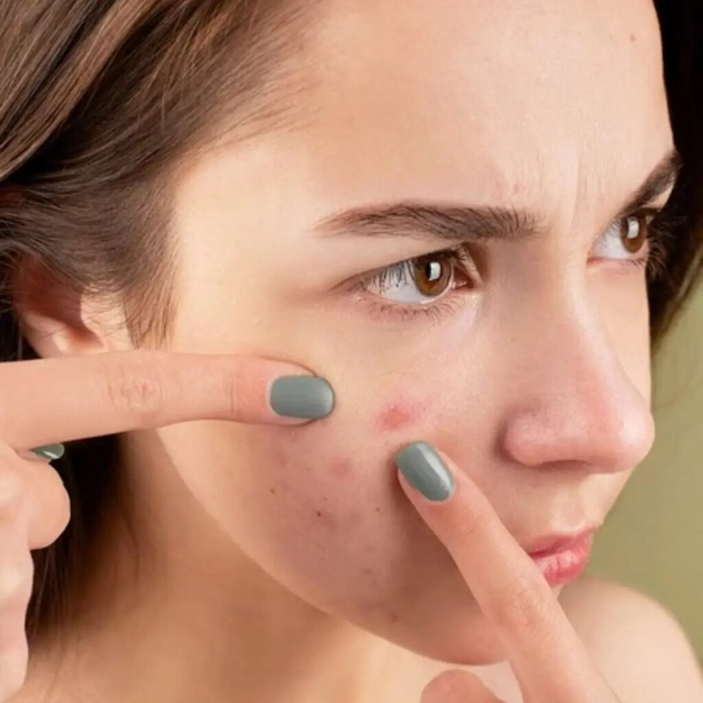 Strawberry Skin Treatment