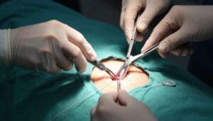 Excisional biopsy removing entire skin lesion with sutures prepared.